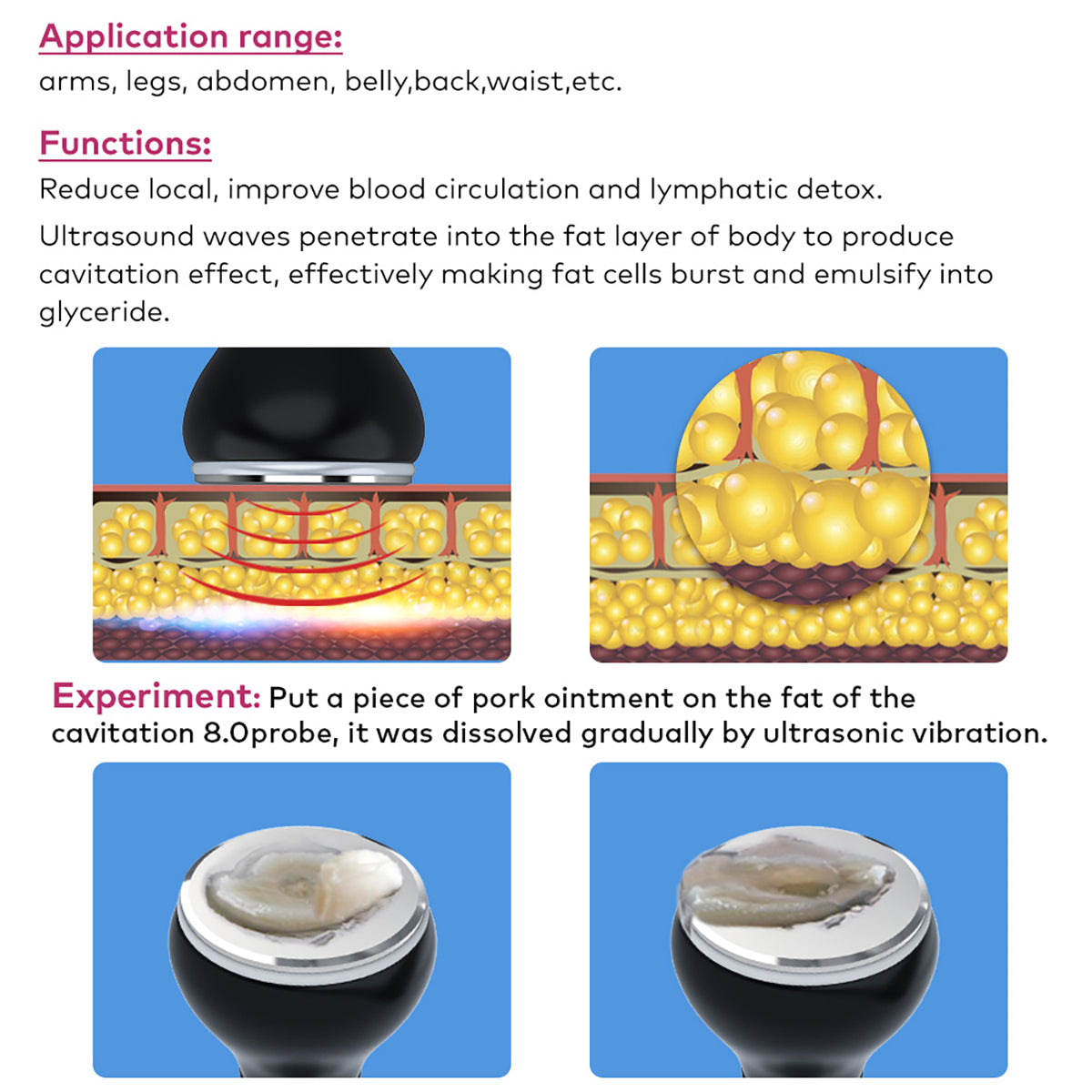 SQ149 Pro 6-in-1 80K Ultrasonic Cavitation & RF + EMS Machine