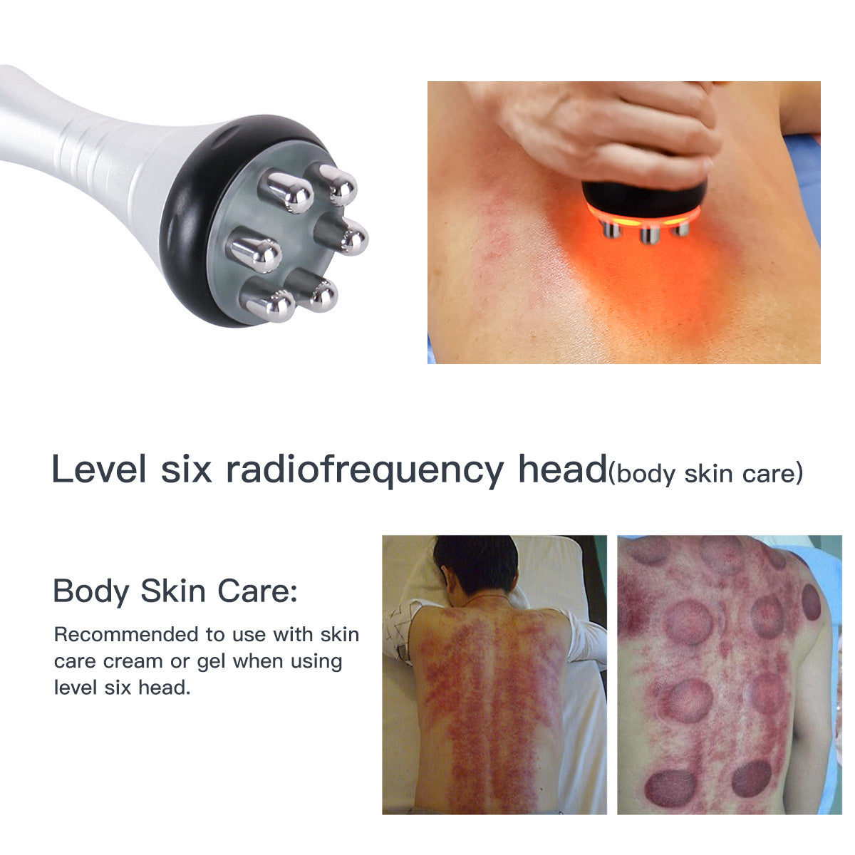 SQ47B Pro 6-en-1 – Cavitation 40K, trois RF, massage sous vide et plaques EMS laser