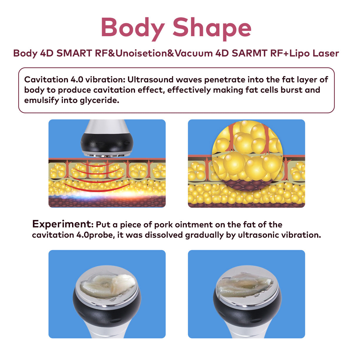 SQ16B Basic – Appareil silhouette 4-en-1, cavitation 40K, RF et vide Image secondaire du produit
