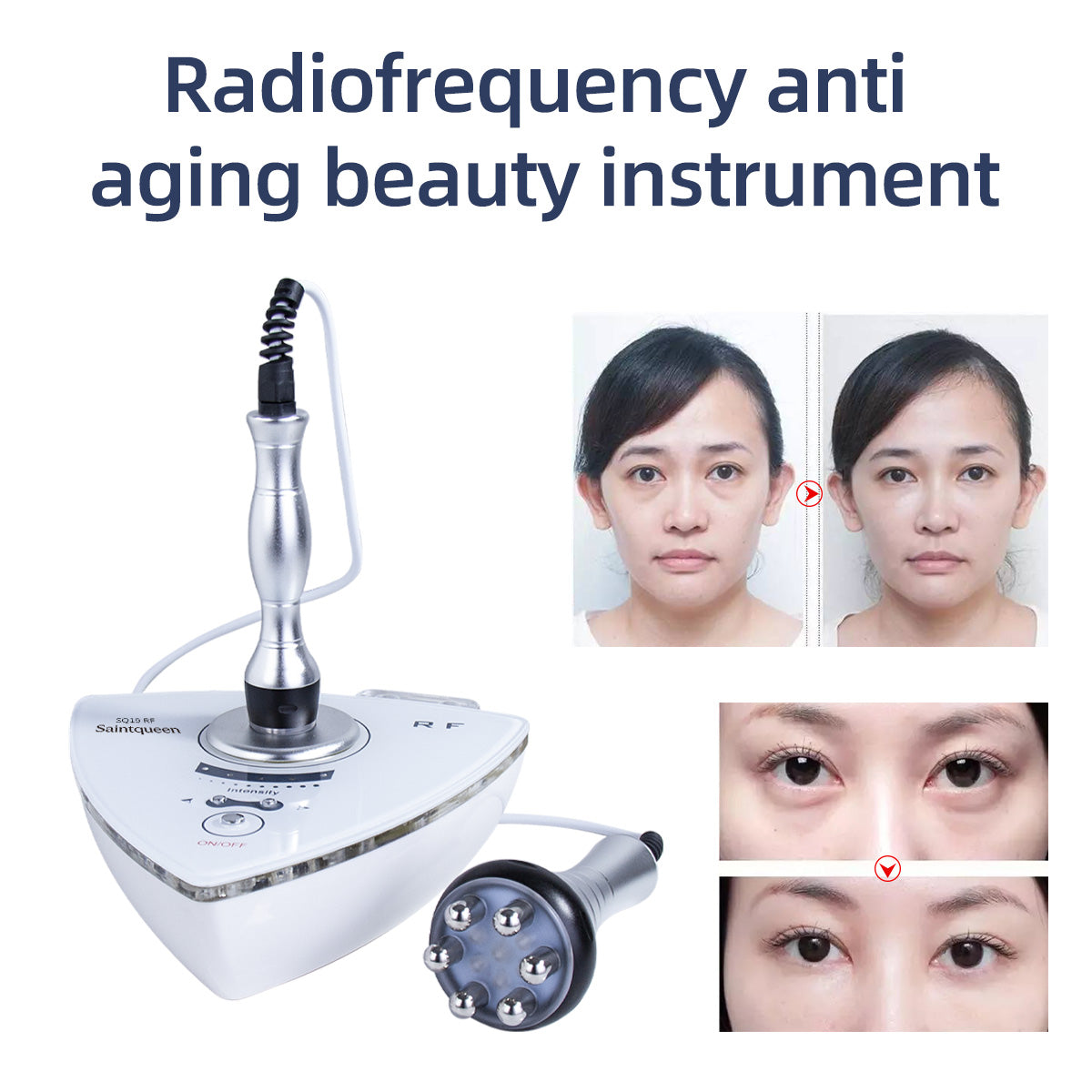 SQ19 RF Face & Body Device with 2 Probes & Red Light Secondary image