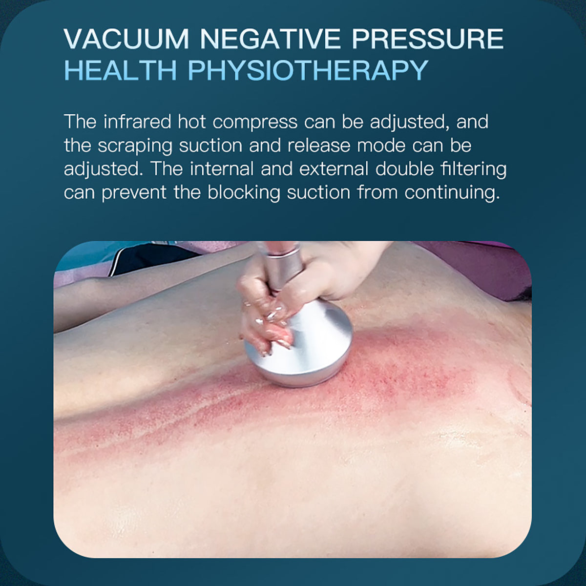 SQ92B Pro 6-in-1 80K Ultrasonic Cavitation & RF Machine with Laser + Microcurrent Pads